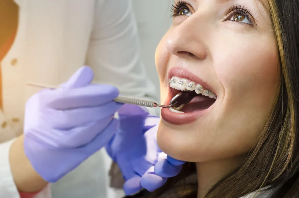 Ortodonzia 1 Apparecchio dentale a Pomezia