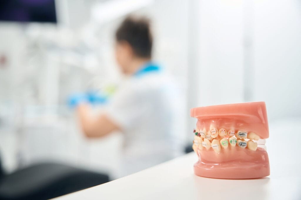 Quanto ci mette l’apparecchio a raddrizzare i denti storti? Tempi e fattori del trattamento ortodontico