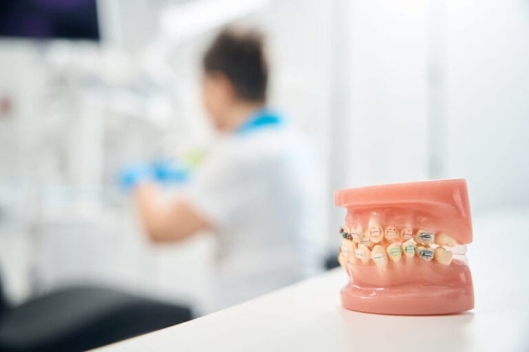 Quanto ci mette l’apparecchio a raddrizzare i denti storti? Tempi e fattori del trattamento ortodontico